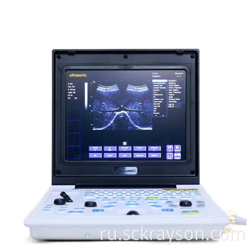 Laptop Ultrasound Screen 3